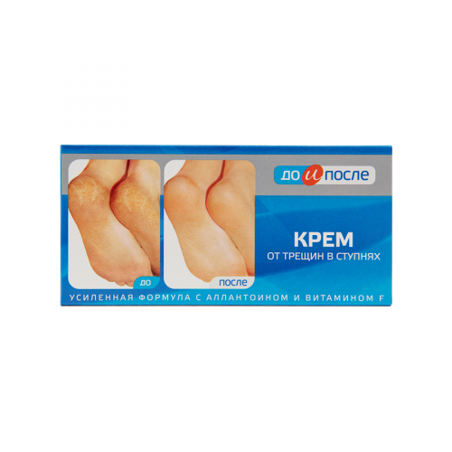 До и После для ног от трещин в ступнях